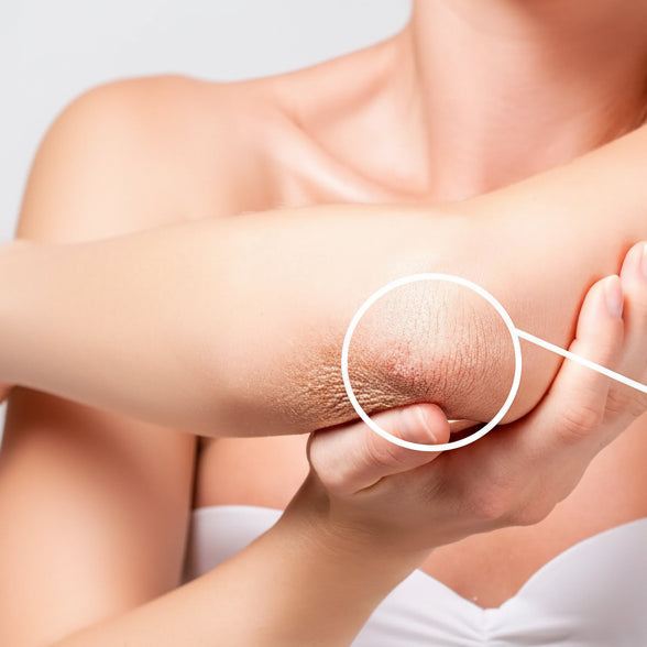 Huile serum anti vergetures grossesse